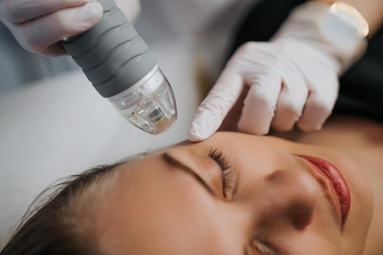 RF microneedling in Cumming, GA